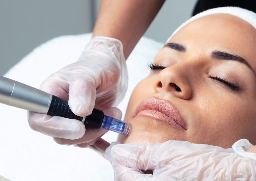 CIT Microneedling