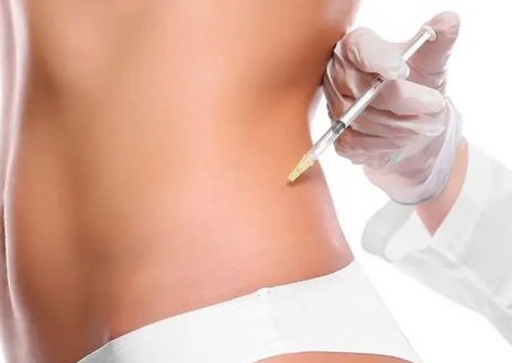 Mesoterapia Corporal