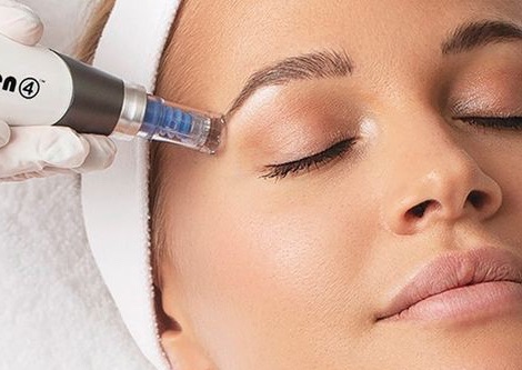 Dermapen con sperma de salmón