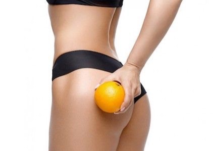 Carboxiterapia x sesión