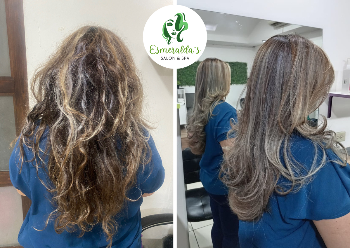 Tratamiento de Células Madres - SOS Reconstrucción