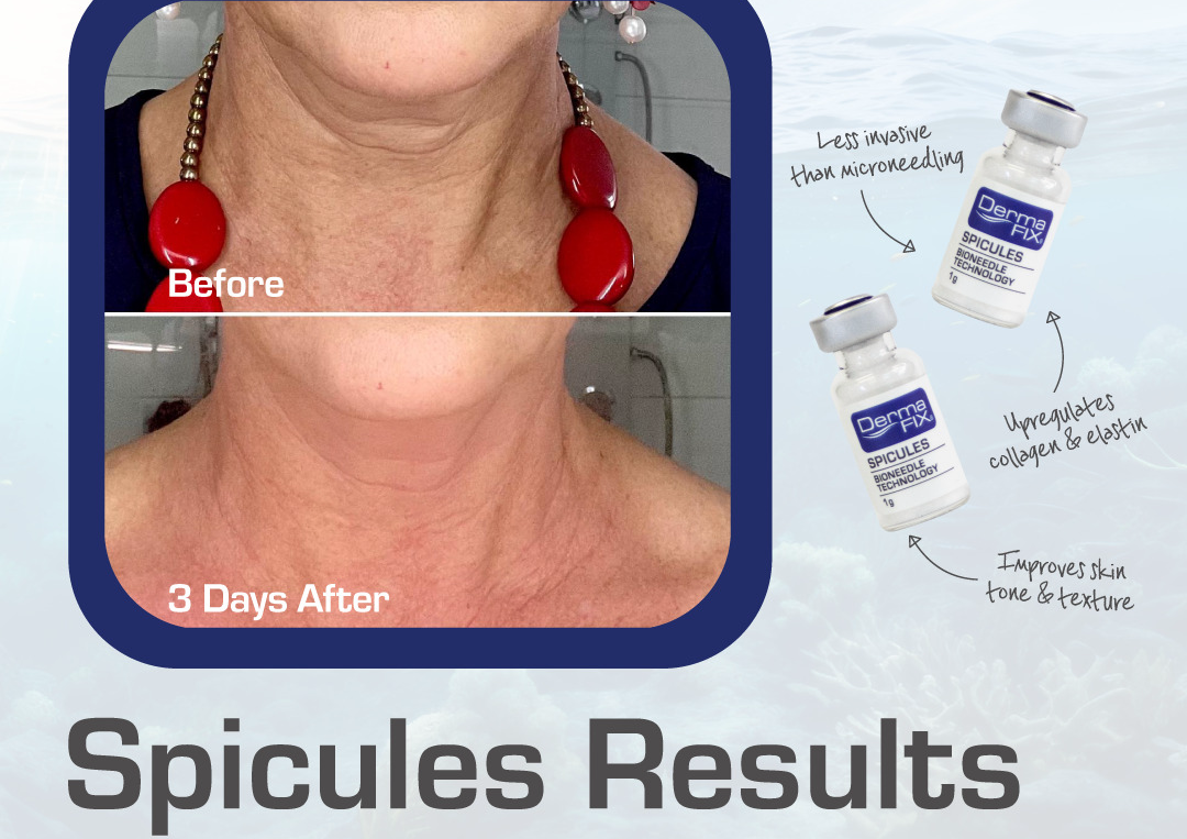 Dermafix Spicule Treatment Face, Neck & Décolleté 
