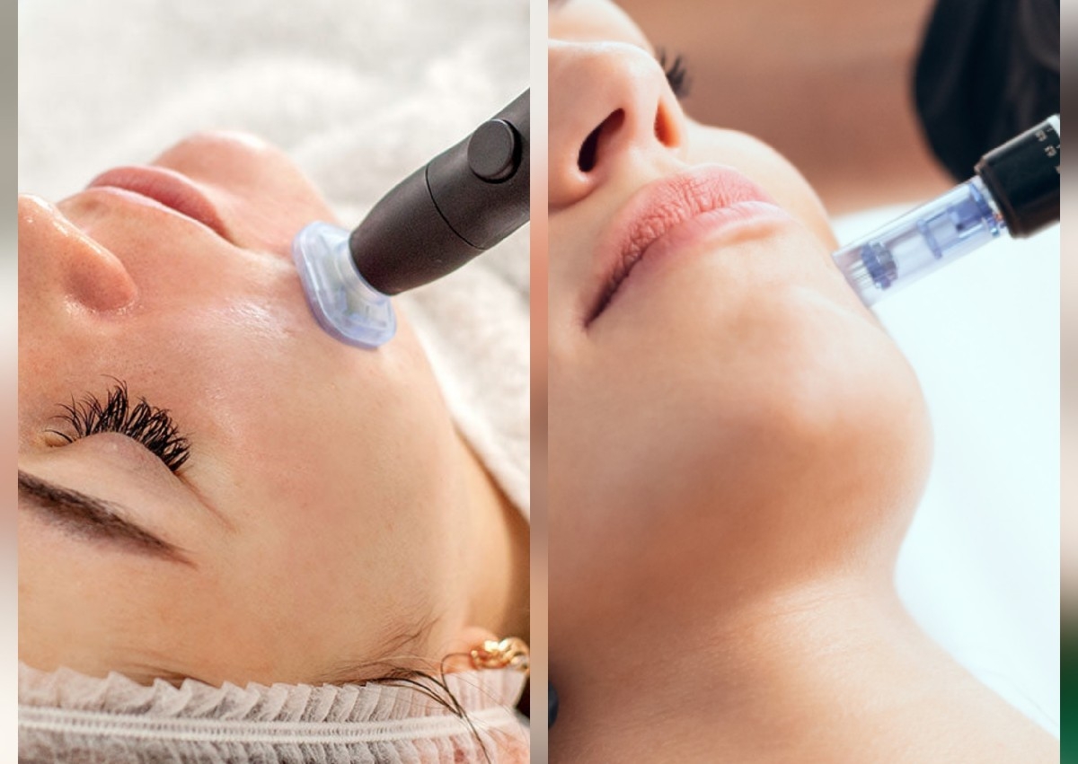 Microneedling Facial + Cool Plasma Facial