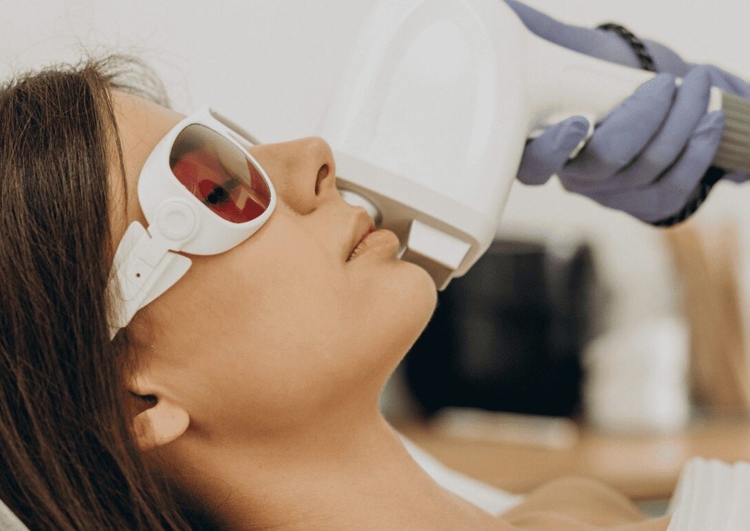 Laser Hair Reduction - Top Lip + Chin