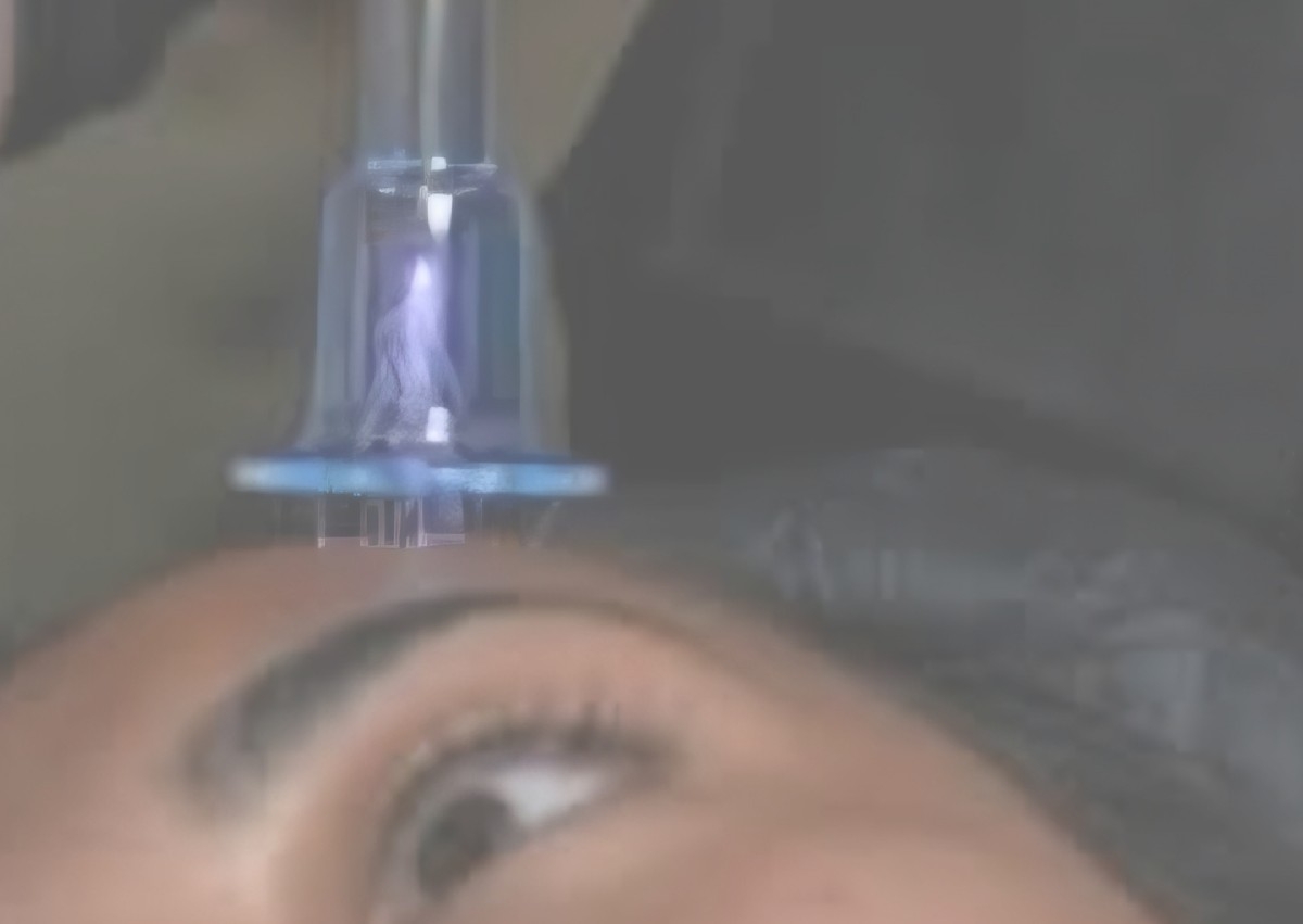 Scalp / Cellulite Plasma