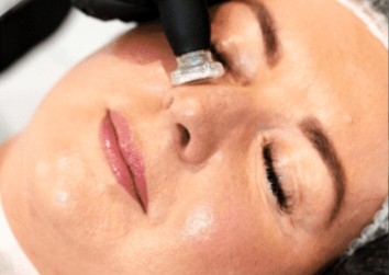 Cool Plasma + RF Massage - Full Facial + Neck 