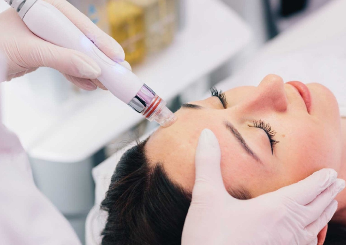 Hydra Nano Needling Facial