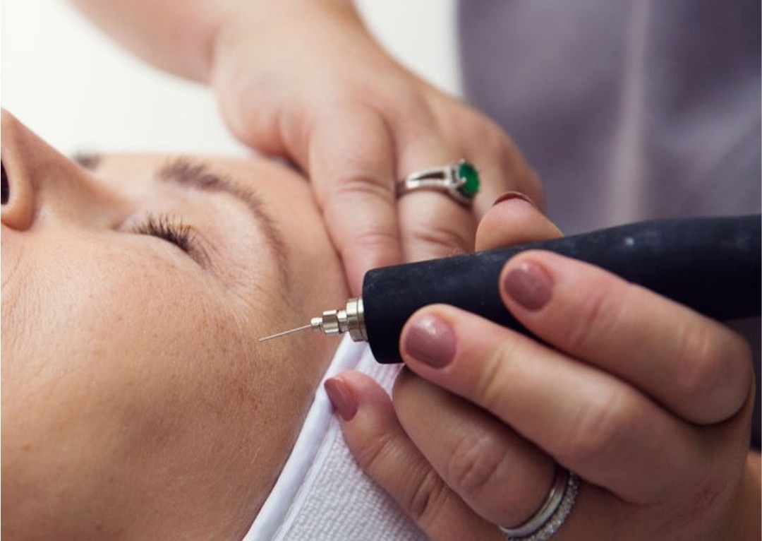 Hot Plasma - Crows Feet