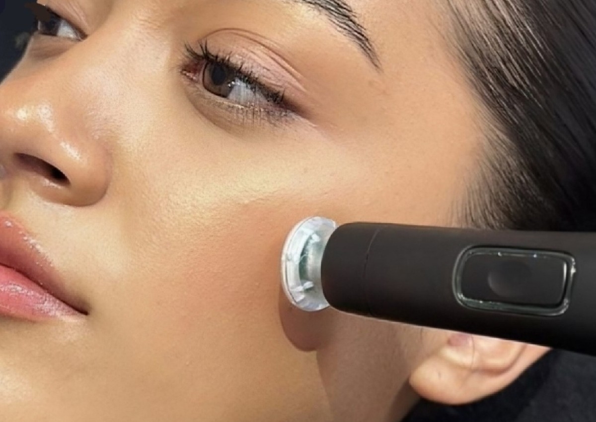 Cool Plasma + RF Massage - Lower or Upper Facial Treatment