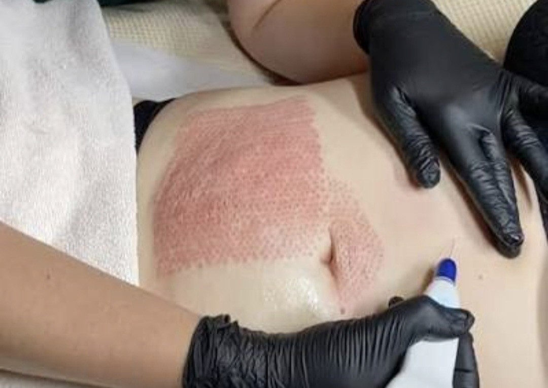 Hot Plasma - Stomach