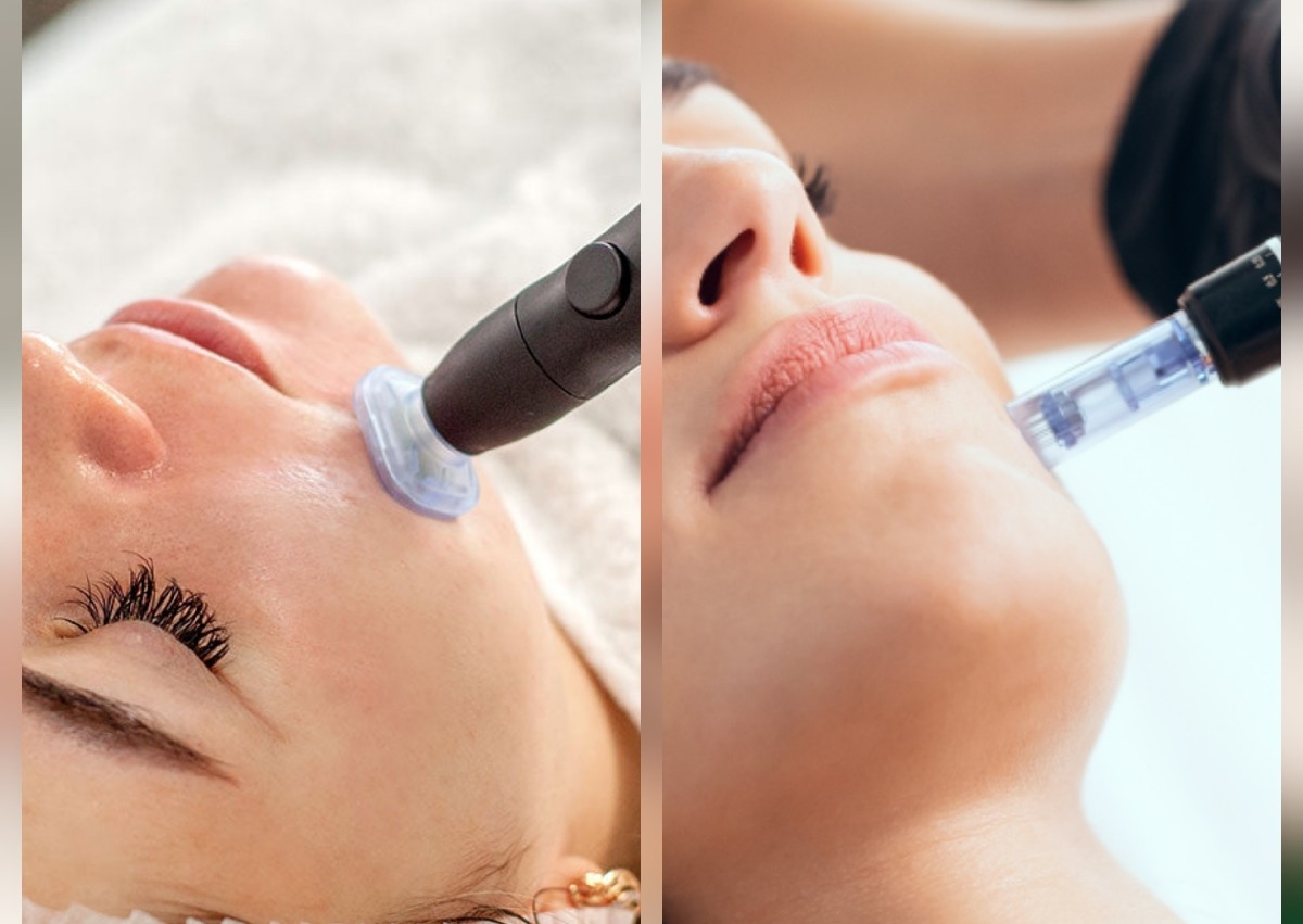 Cool Plasma + Microneedling Facial