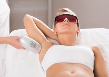 Laser Hair Reduction - Underarms
