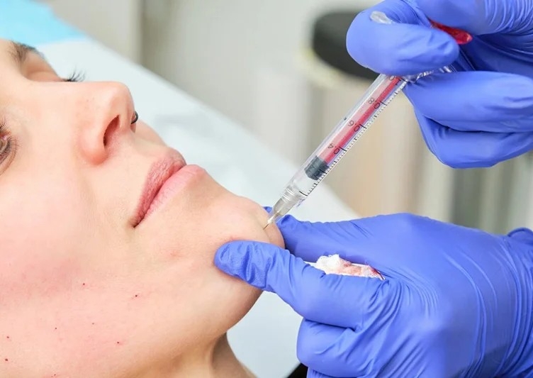 Botox - Cobbled Chin