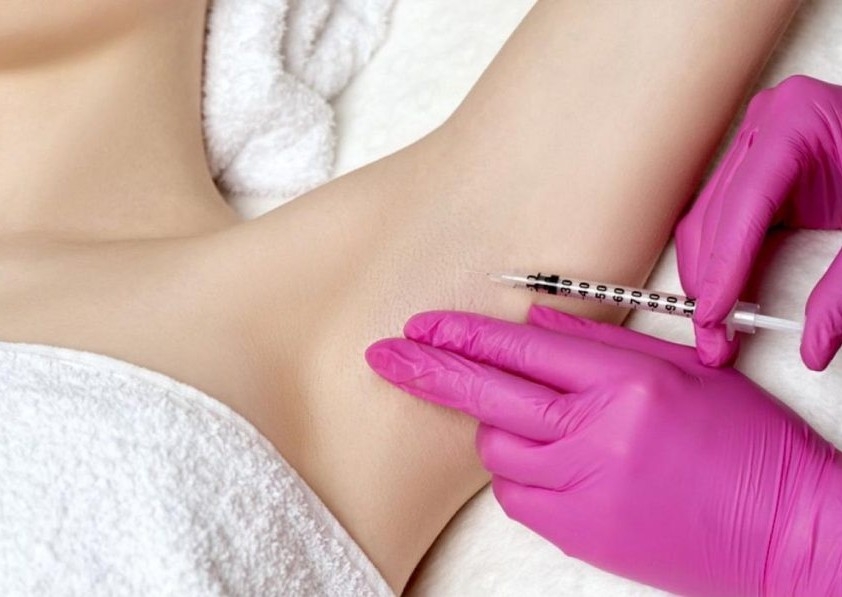 Botox - Underarm Sweating