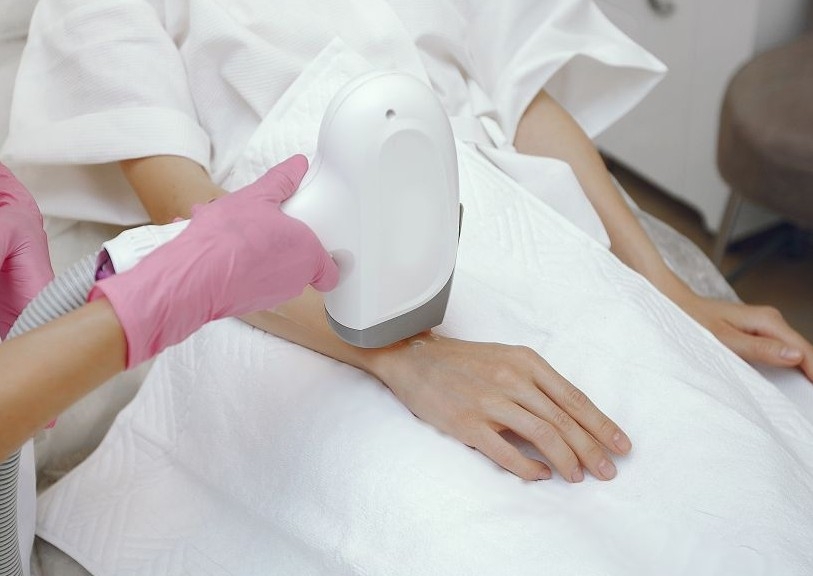 Laser Hair Reduction - Hands or Feet