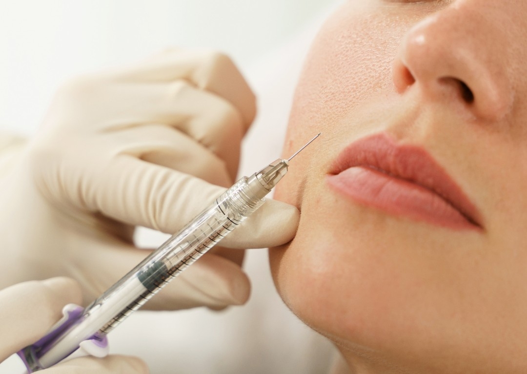 Botox - Marionette Lines / Downturned Mouth