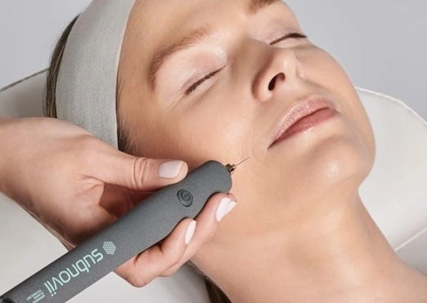 Hot Plasma - Nasolabial Lines