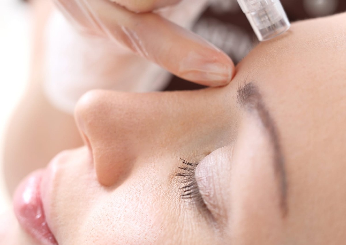 Microneedling Vitamin C - Healthy Glow