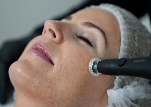 Cool Plasma + RF Massage - Acne Treatment