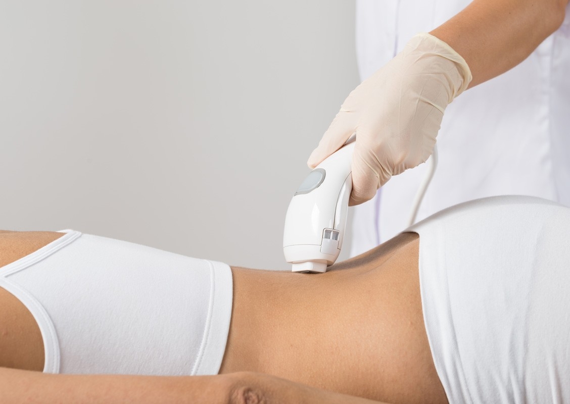 Laser Hair Reduction - Back or Chest