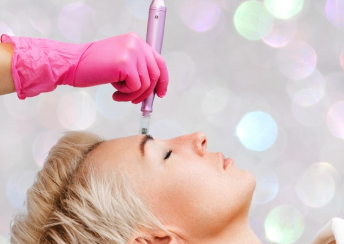 Microneedling Lemon Bottle - Radiance Skin Booster