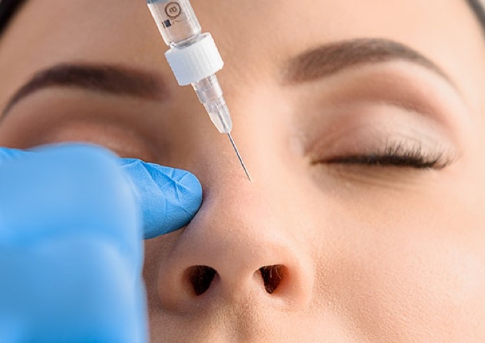 Botox - Bunny Lines on Nose