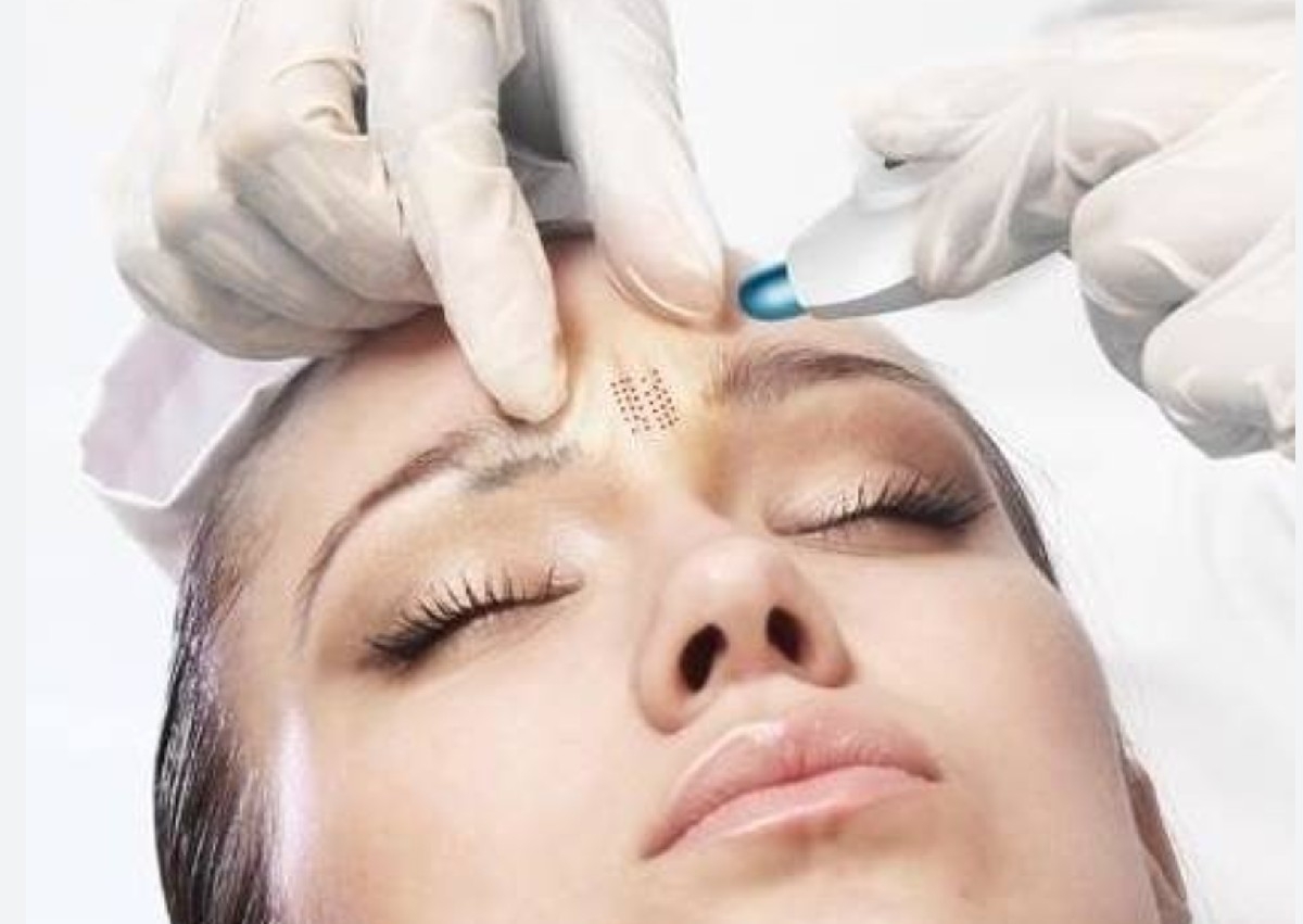 Hot Plasma - Frown Lines