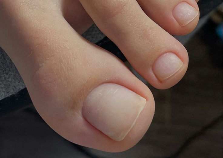Regular pedicure 