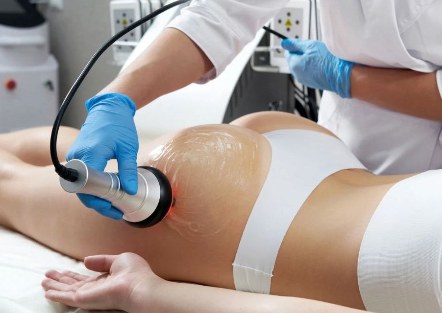 Body Sculpting per section (stomach, back or front leg)