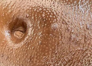 Navel ( Nombril)
