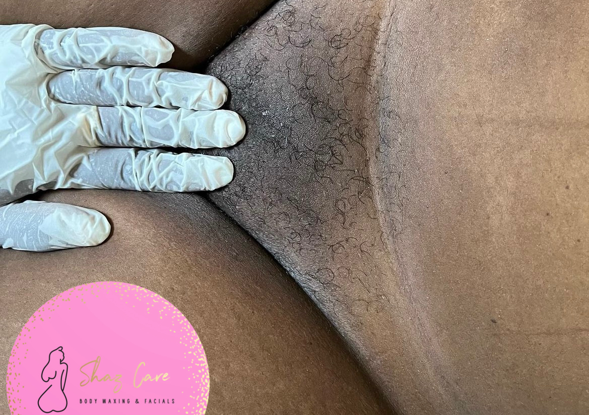 Laser Clean Up (Brazilian)/ Laser brésilien