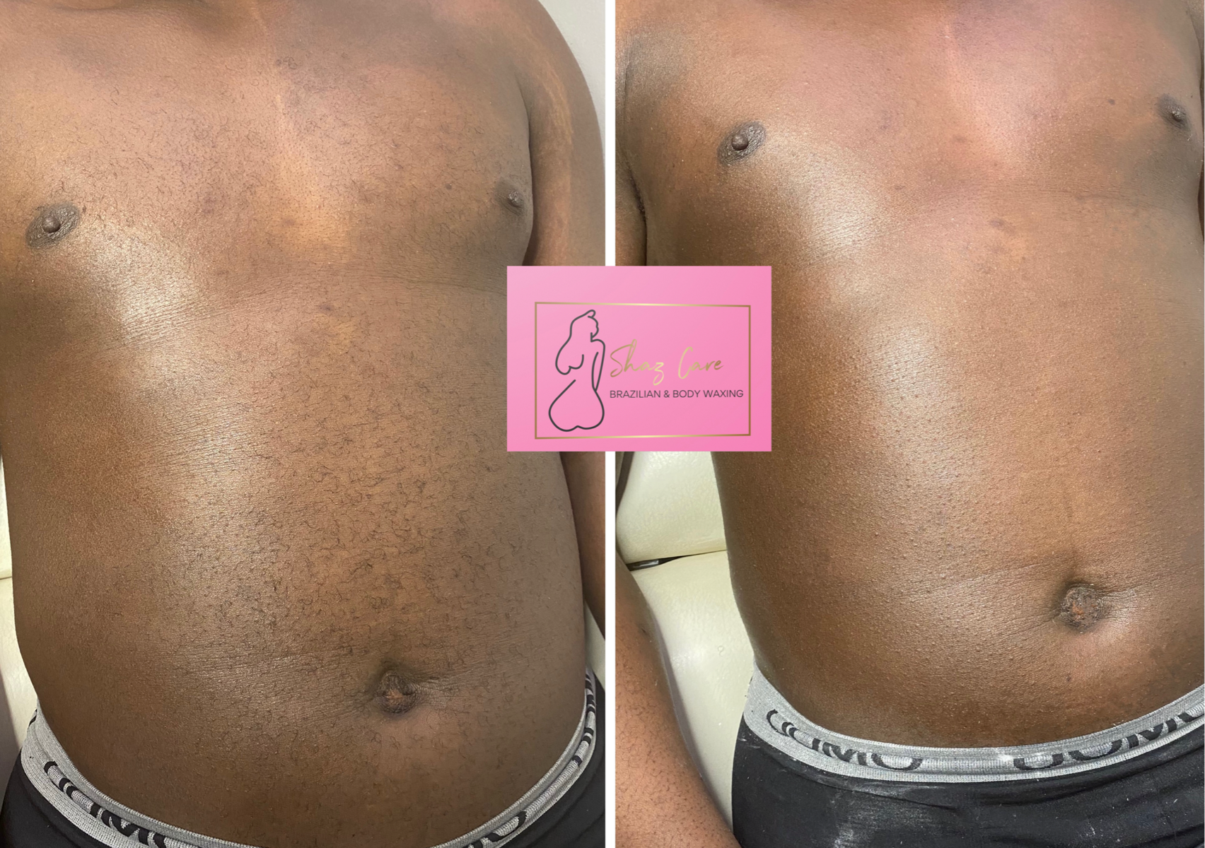 Full Chest / Poitrine au Complet