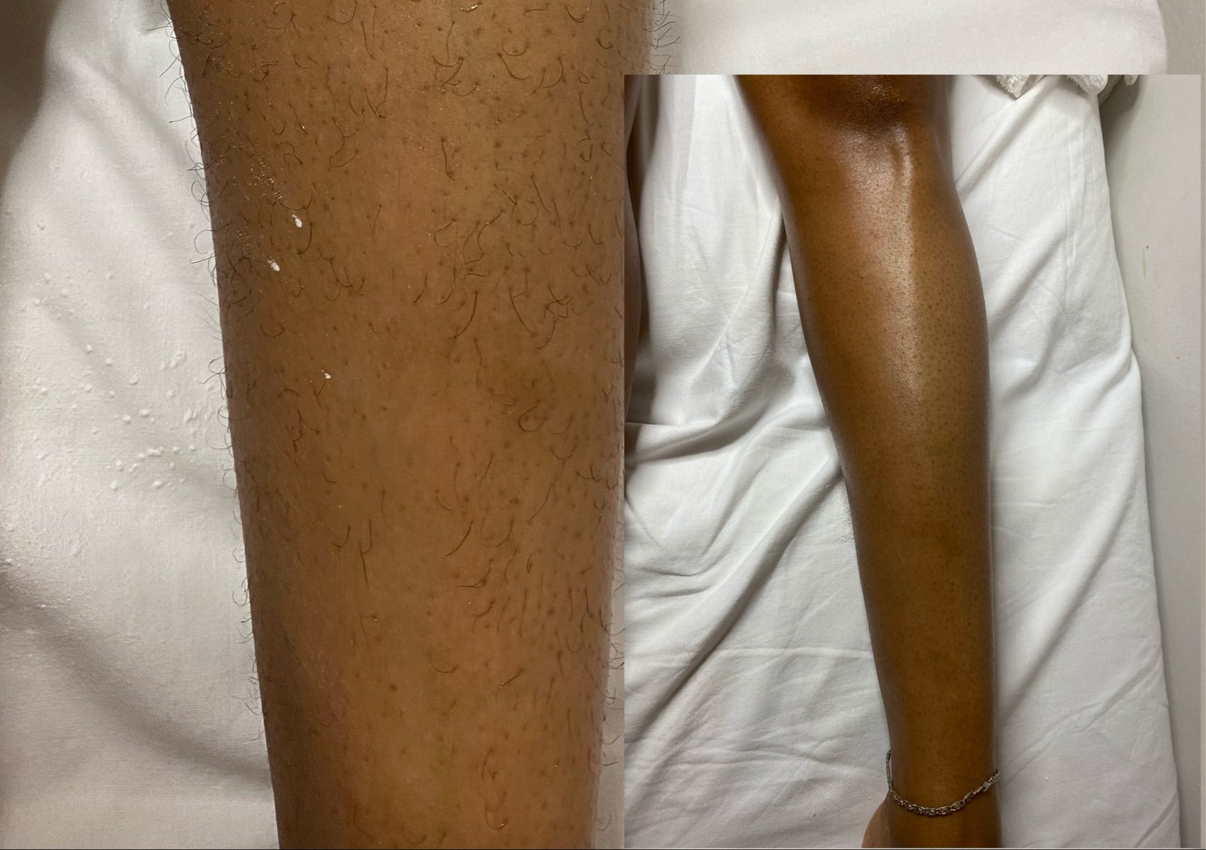 Lower Legs / Jambes Inférieur