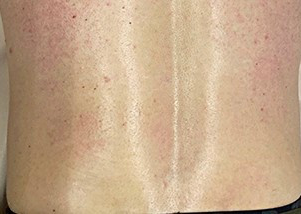 Half Back / Demi Dos