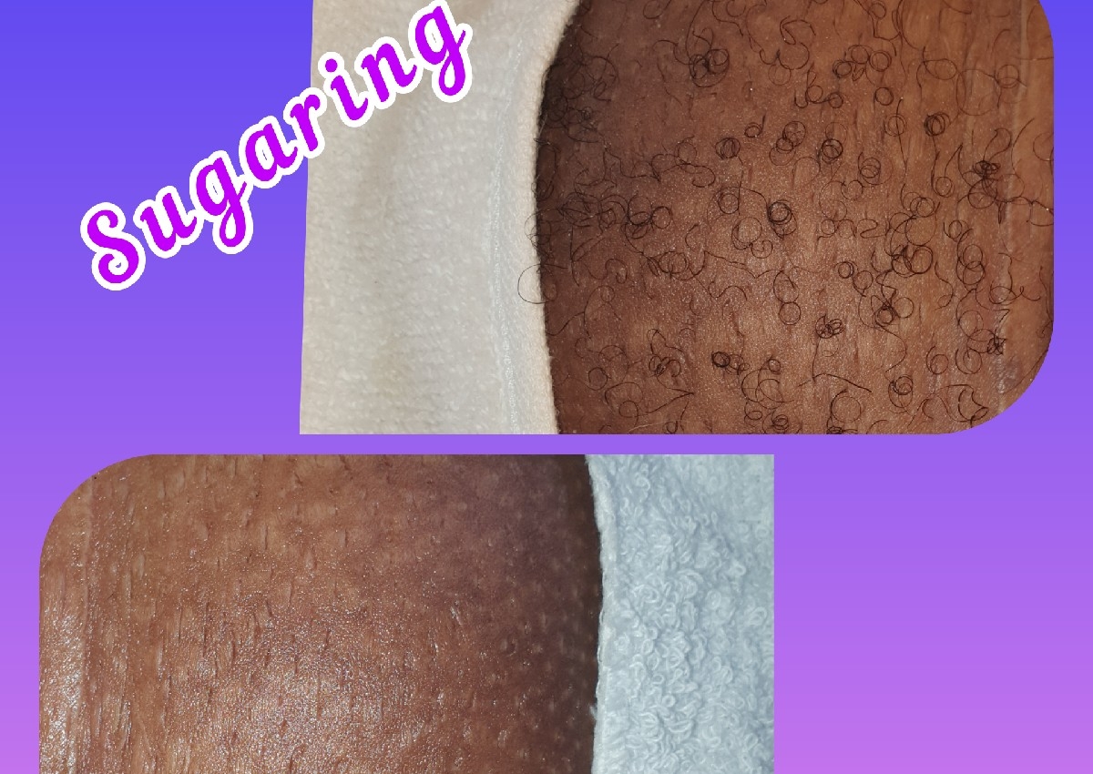 Brazilian sugaring