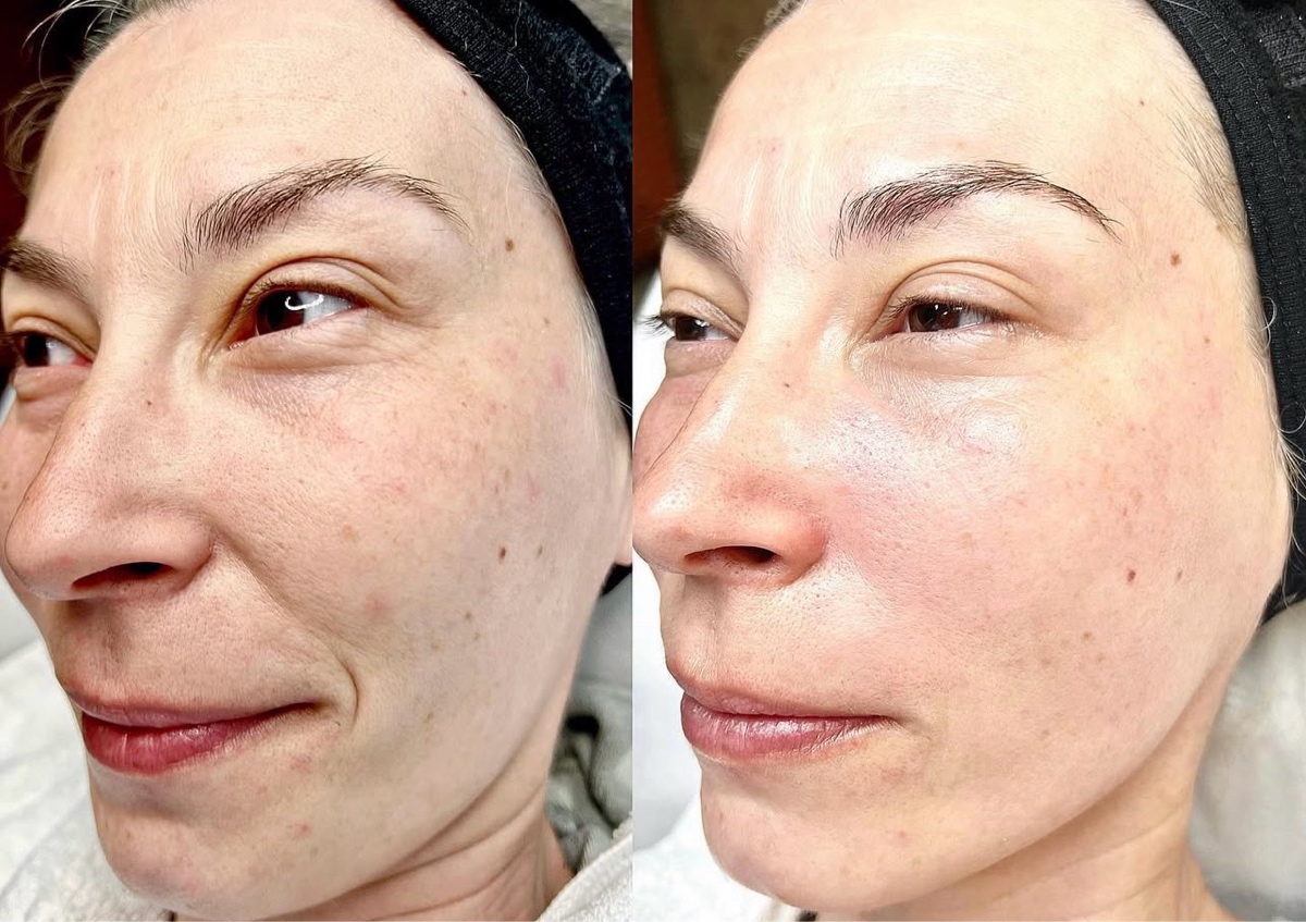 Express Facial with Red light therapy