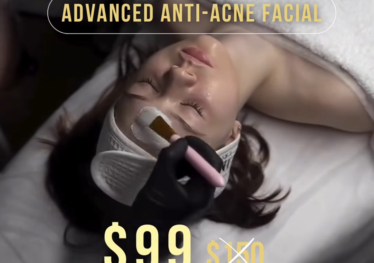 Advance anti-acne  facial