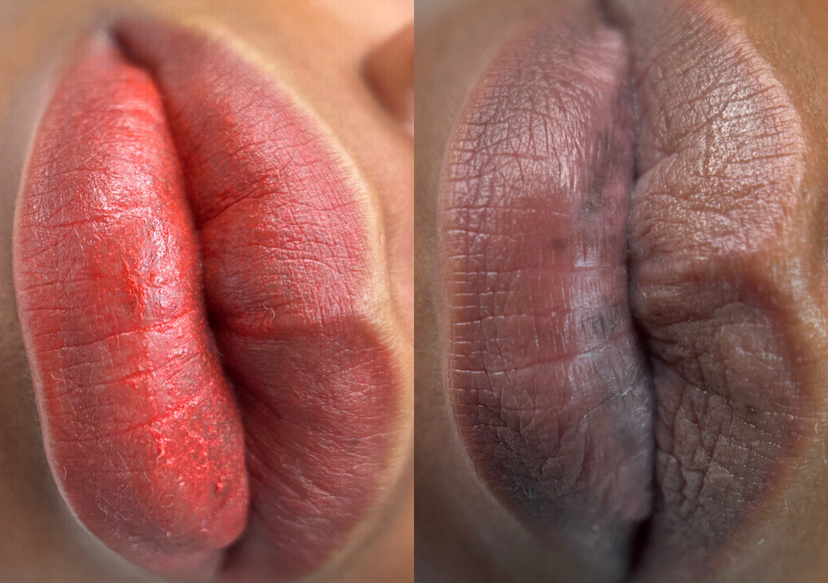 Neutralización de labios oscuros 