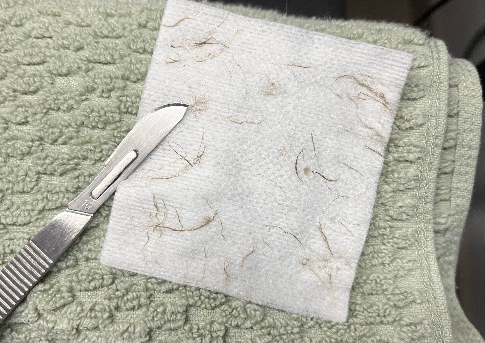 Defodio (Dermaplaning) 