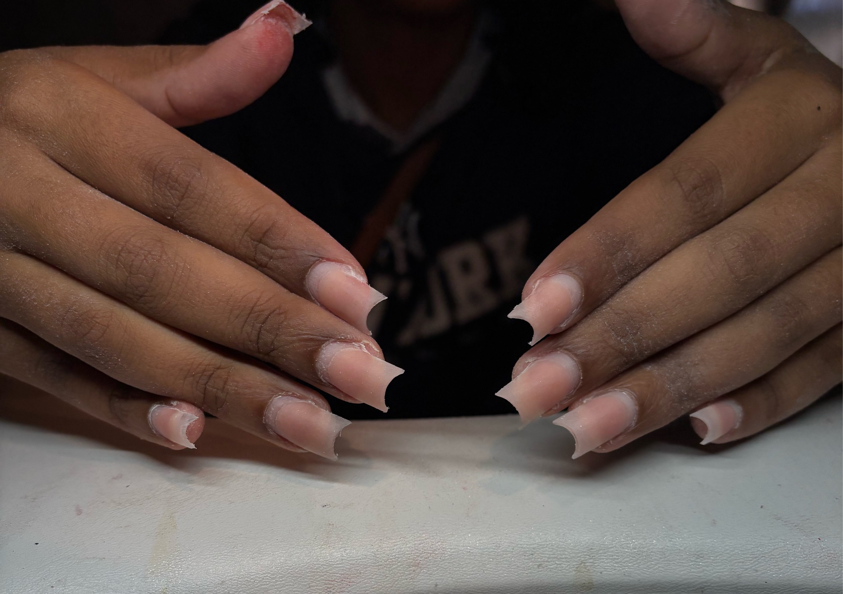 Nail fill-in