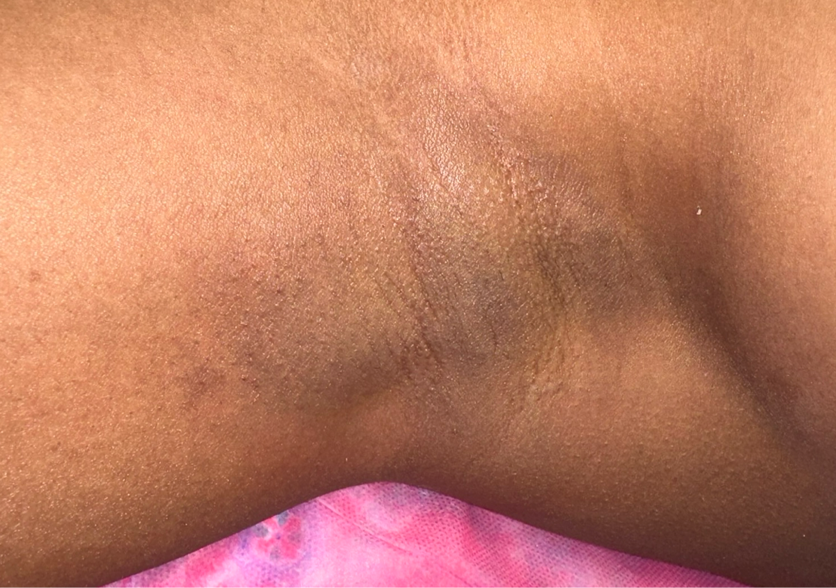 Underarm wax (female)