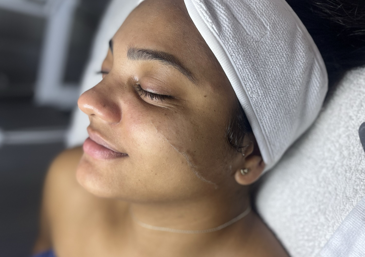 Dermaplaning En Facial