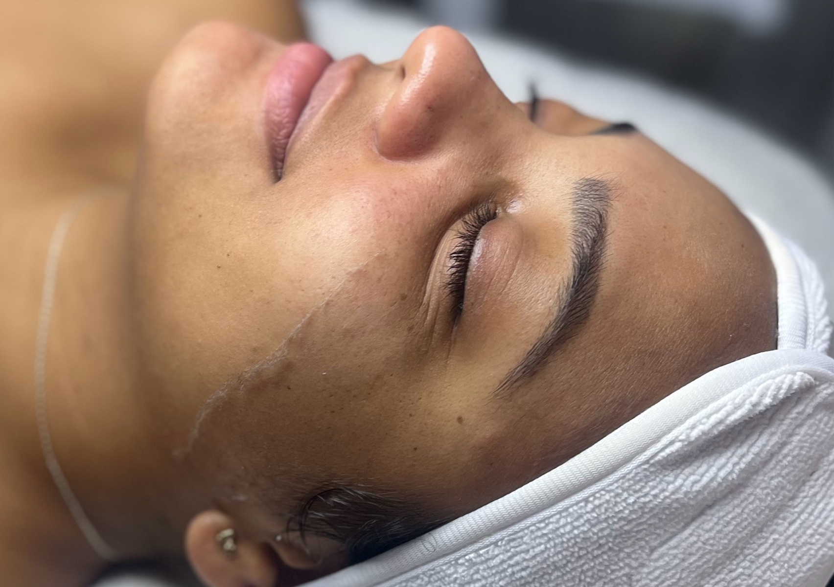 Dermaplaning Navideño