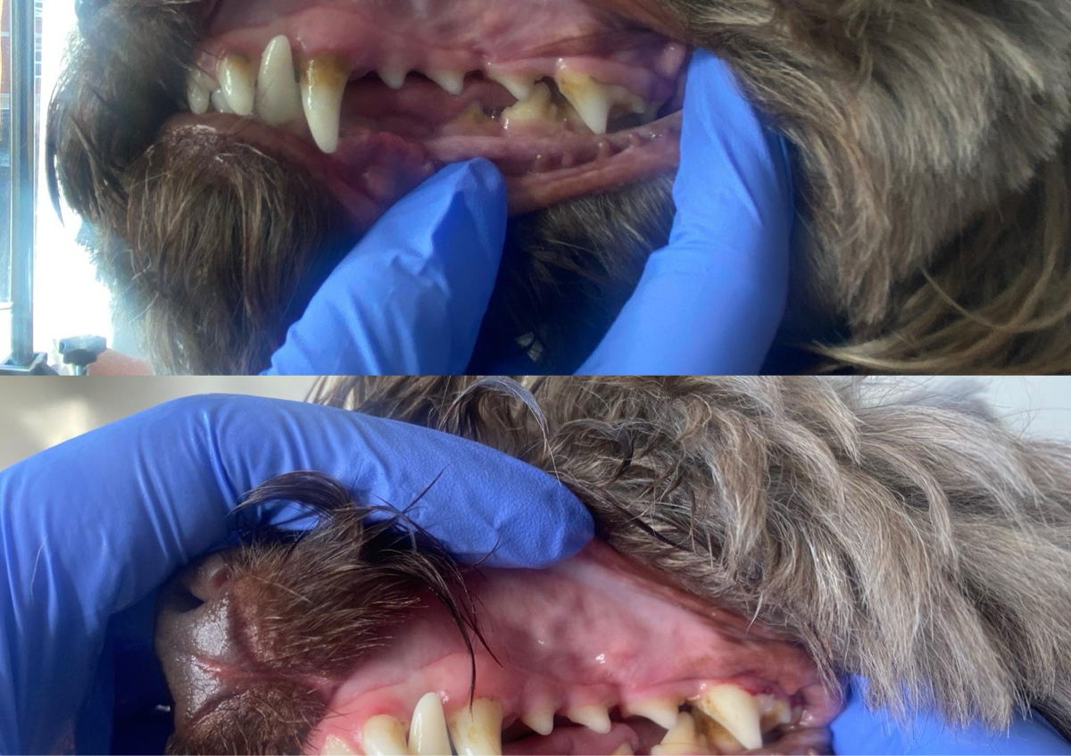 Teeth cleaning first session 