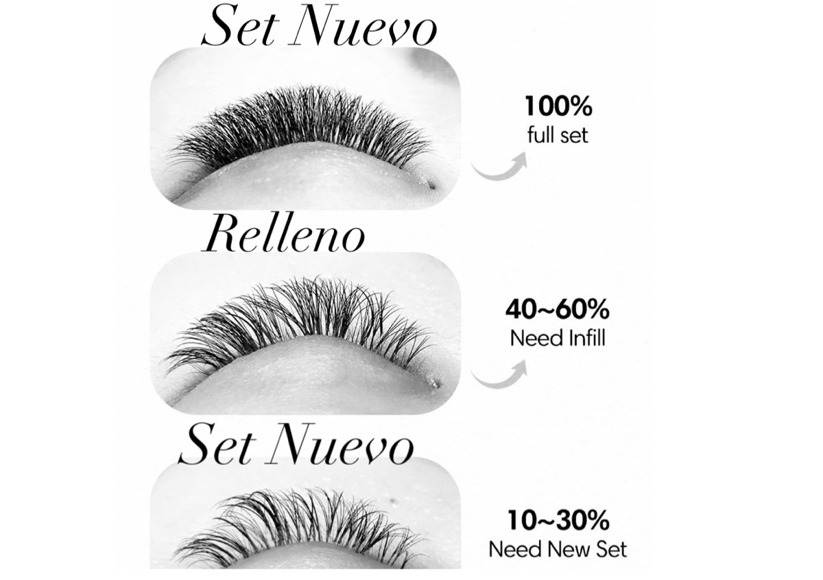 Mega volume fill / relleno 