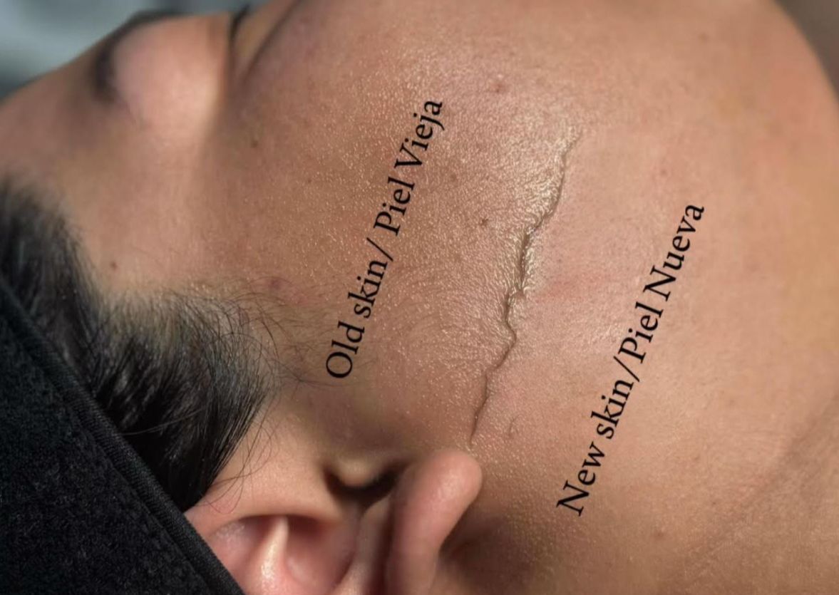 Dermaplaning Add On / Dermaplaning añadido al facial