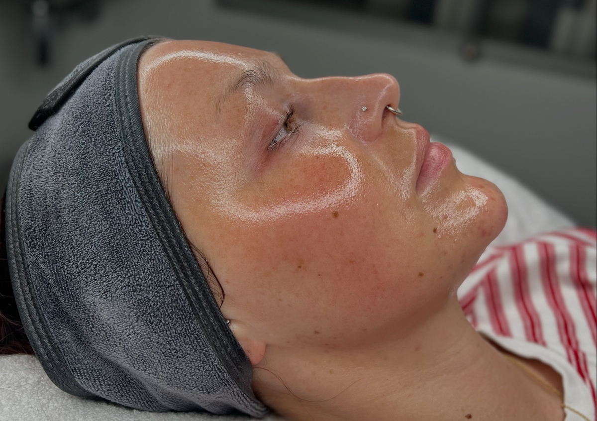 Dermaplane Deluxe