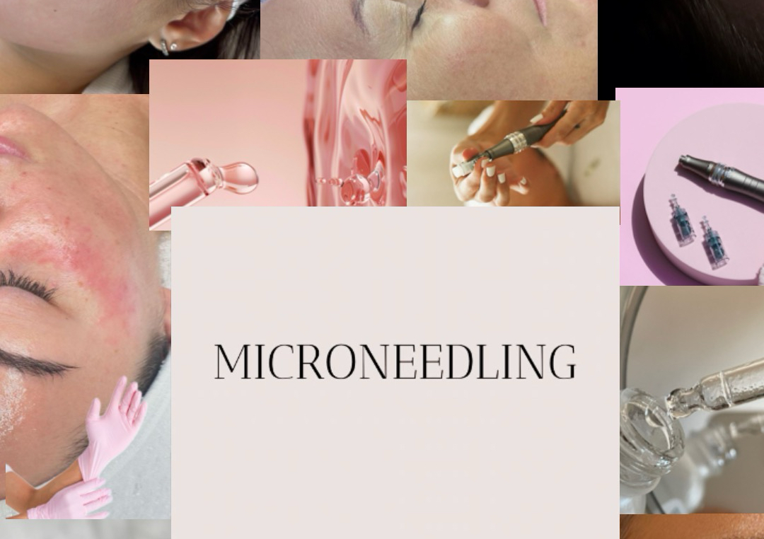 Microneedling 