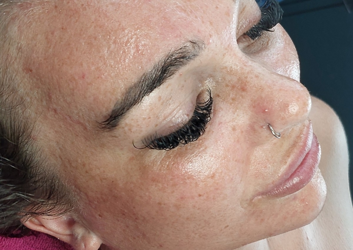 Skin booster Facial ( injectable ) 
