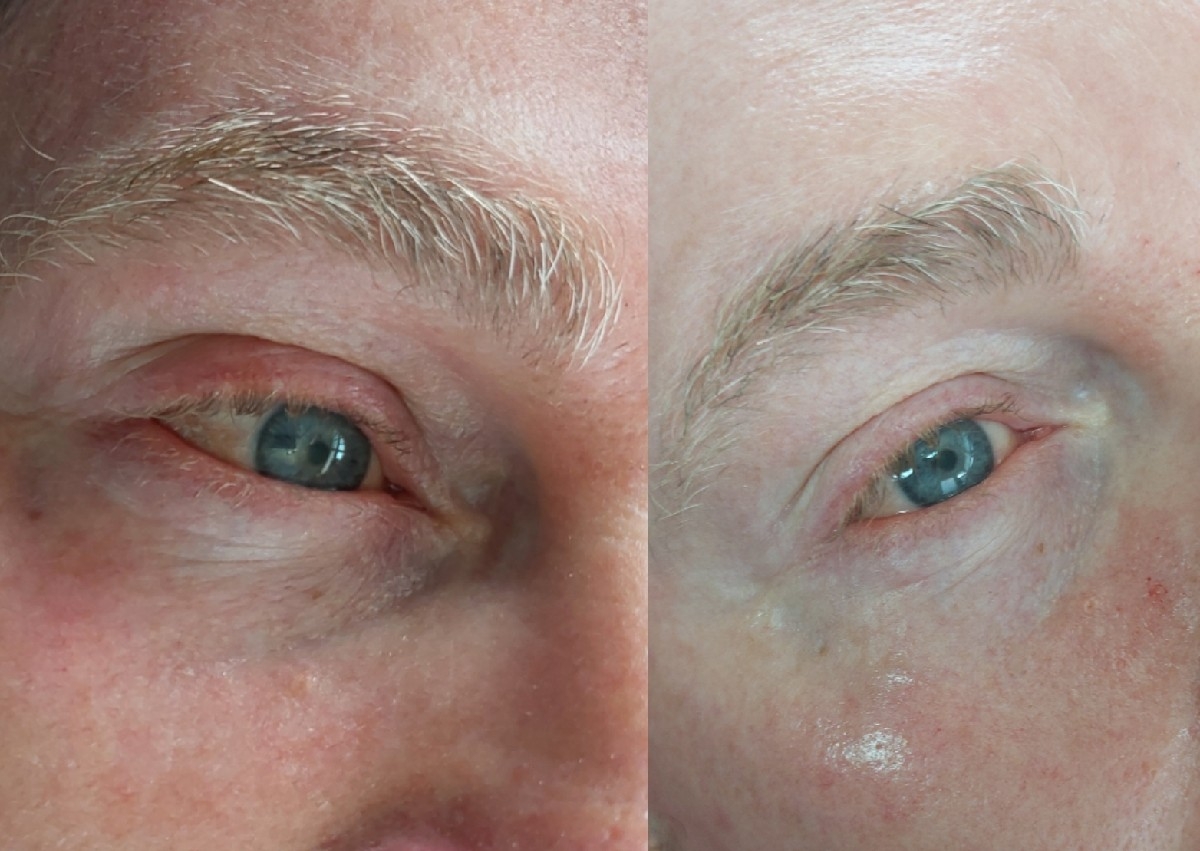 Lumi eyes pro